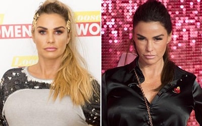 A picture of Katie Price before (left) and after (right).